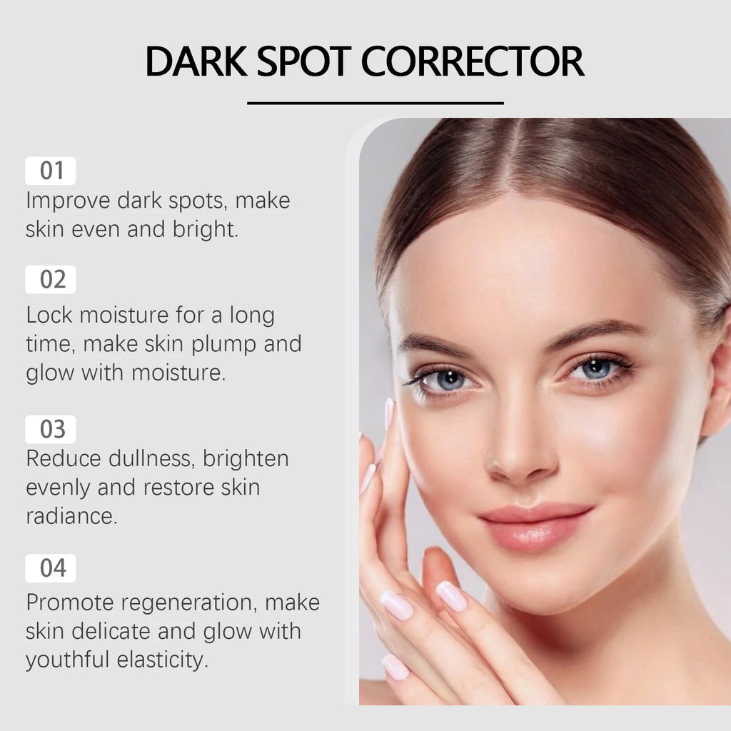 Hoygi 30ml Dark Spots Repairing Cream Nourish Face Remove Melanin Even Skin Rejuvenation Improve Dullness Brighten Facial Lotion