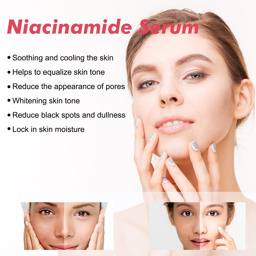 Niacinamide Face Serum Firming Skin Fade Fine Lines Pore Shrink Remove Dark Spots Smoothing Skin Glowing Face Serum