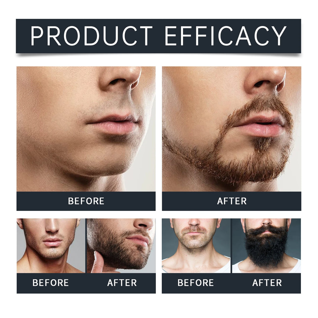 East Moon Men Beard Care Set for Cleaning Strengthen Nourishing Beard Promote Beard Growth Moisturizing Men Whisker Care Set