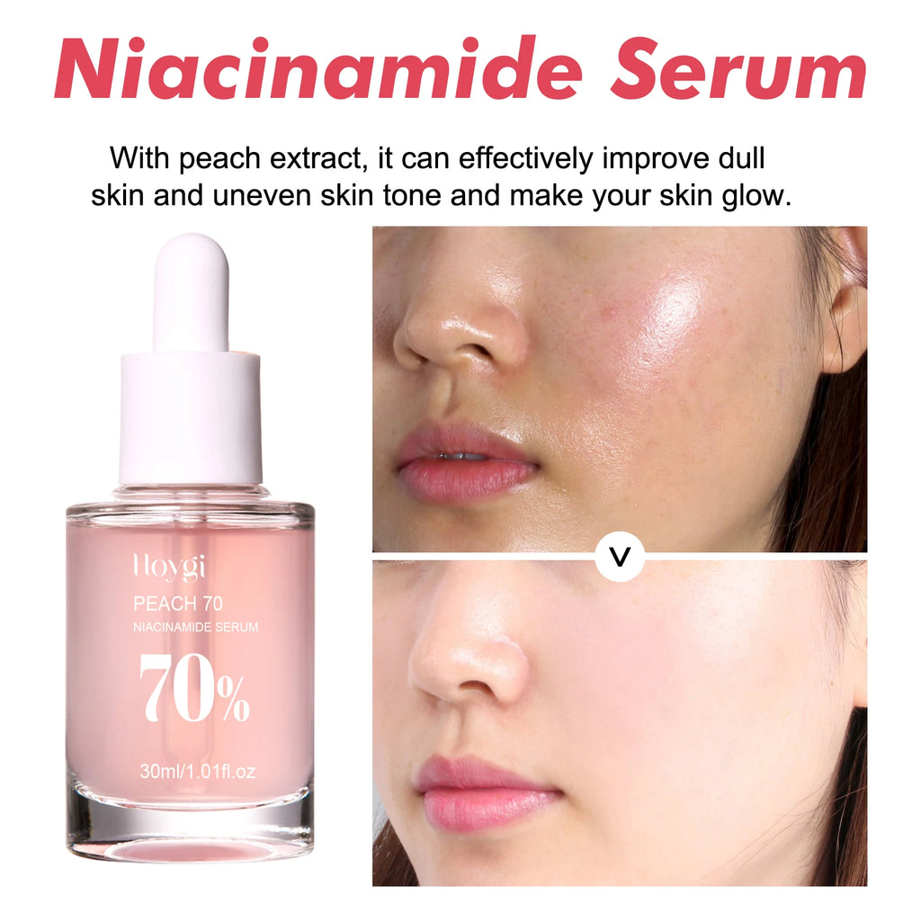 Niacinamide Face Serum Firming Skin Fade Fine Lines Pore Shrink Remove Dark Spots Smoothing Skin Glowing Face Serum