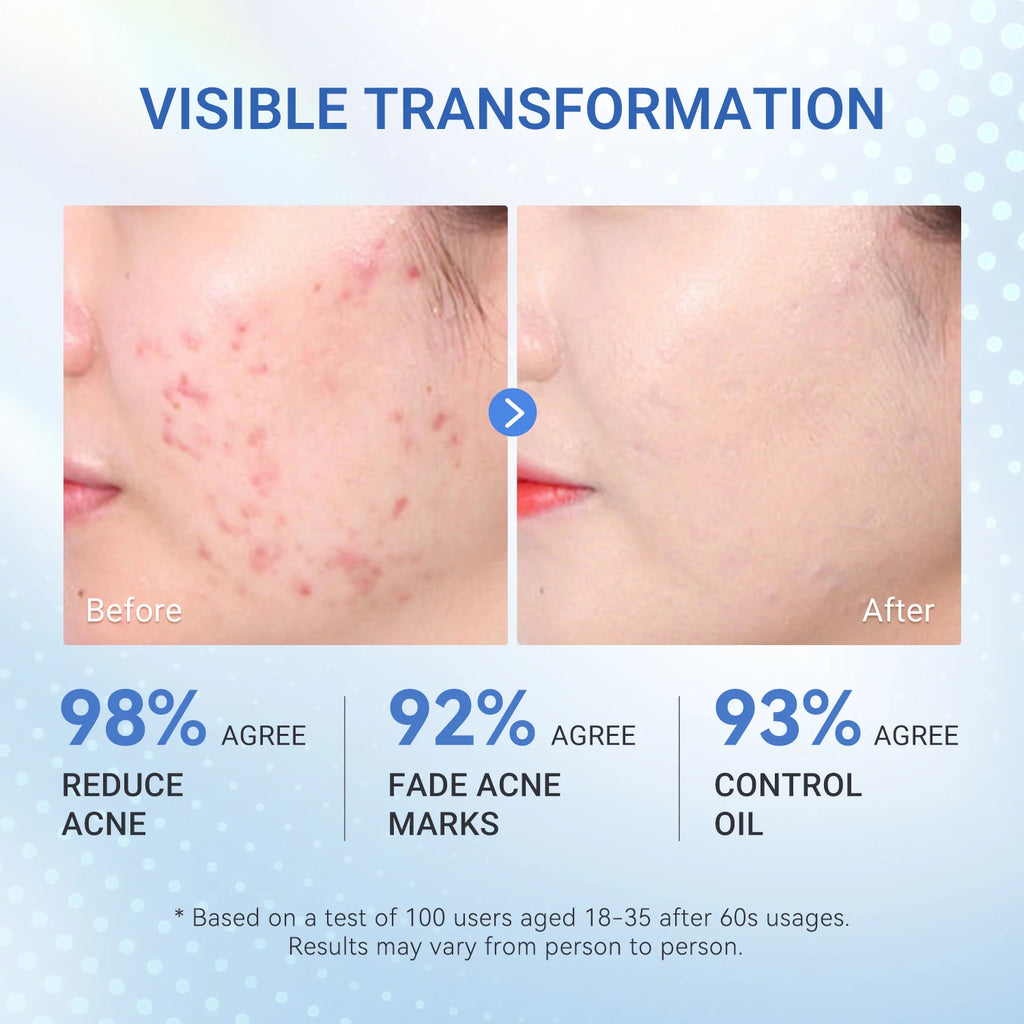 Dr.Leo Acne Serum Salicylic Acid Acne Essence Anti-acne Serum Pimple Removal Acne Scars And Pores Skin Care