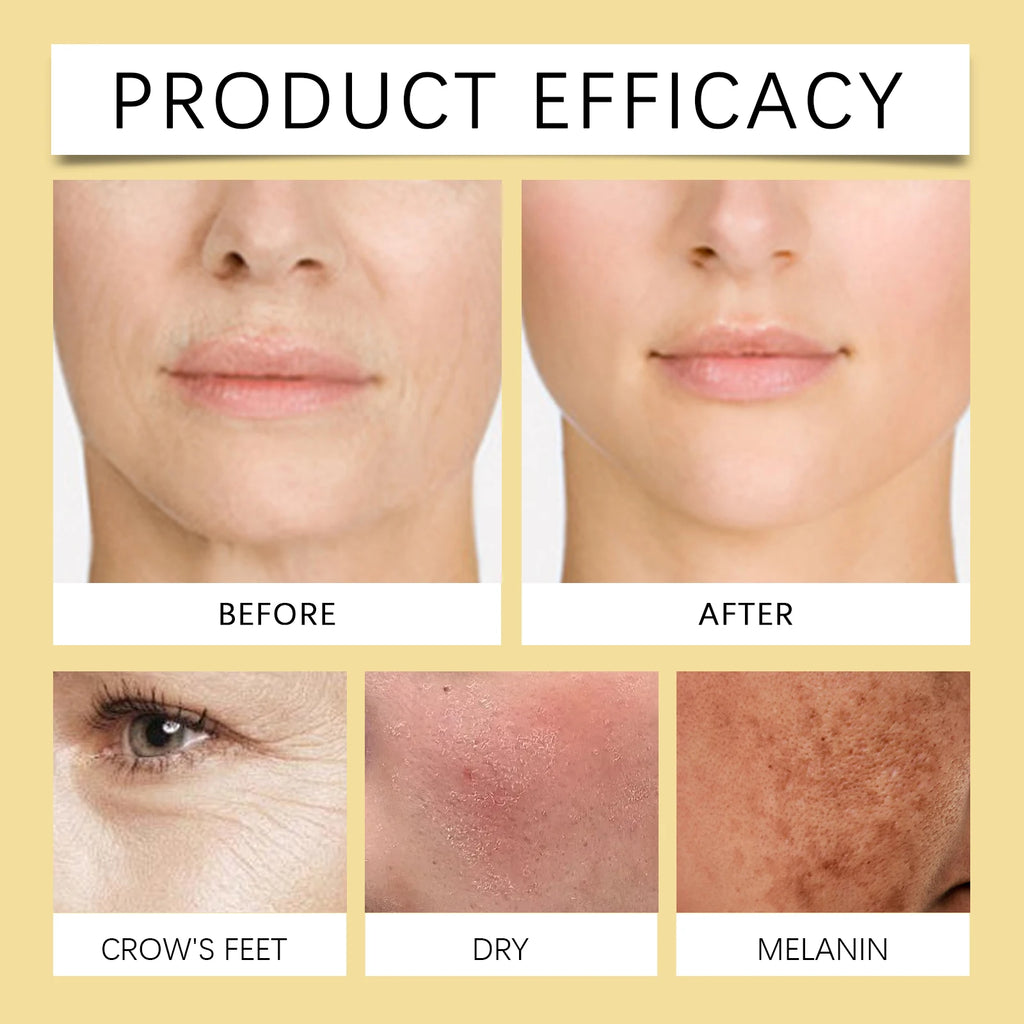 Bee Venom Cream Face Remove Wrinkles Lifting Firming Improve Skin Sagging Tightening Nourishing Repair Anti-Aging Moisturizing