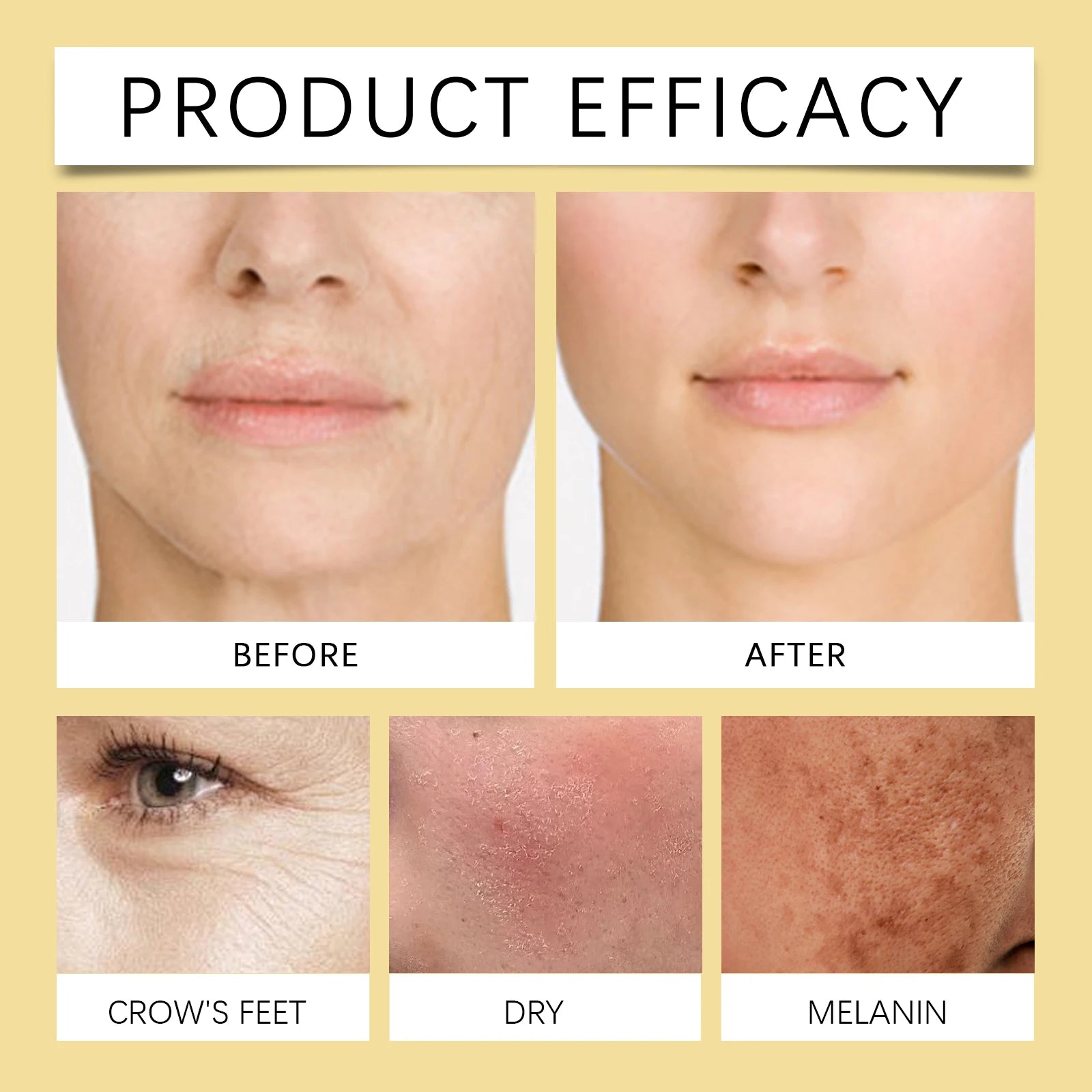 Bee Venom Cream Face Remove Wrinkles Lifting Firming Improve Skin Sagging Tightening Nourishing Repair Anti-Aging Moisturizing
